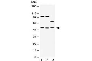 Western blot testing of 1) rat brain, 2) mouse brain and 3) human HeLa lysate with AZIN2 antibody at 0. (ADC anticorps)