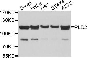 Western blot analysis of extracts of various cell lines, using PLD2 antibody (ABIN6003877) at 1/1000 dilution. (Phospholipase D2 anticorps)