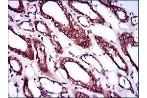 Immunohistochemical analysis of paraffin-embedded kidney tissues using BMPR1A mouse mAb with DAB staining. (BMPR1A anticorps  (AA 179-378))