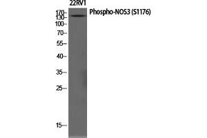 Western Blotting (WB) image for anti-Nitric Oxide Synthase 3 (Endothelial Cell) (NOS3) (pSer1177) antibody (ABIN5961402) (ENOS anticorps  (pSer1177))