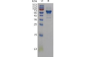 Human AREG Protein, hFc Tag on SDS-PAGE under reducing condition. (Amphiregulin Protein (AREG) (AA 20-187) (Fc Tag))