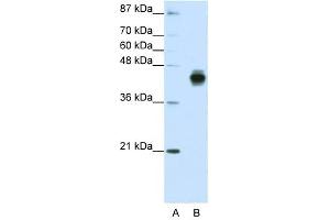 Cytokeratin 18 antibody used at 1. (Cytokeratin 18 anticorps  (C-Term))