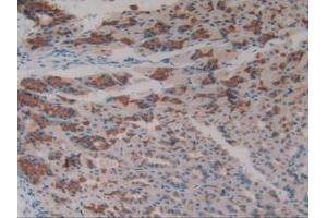 IHC-P analysis of Mouse Stomach Tissue, with DAB staining. (Asialoglycoprotein Receptor 1 anticorps  (AA 80-281))