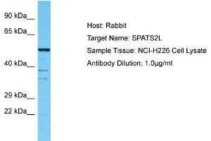 Host: Rabbit Target Name: SPATS2L Sample Tissue: Human NCI-H226 Whole Cell Antibody Dilution: 1ug/ml (SPATS2L anticorps  (N-Term))