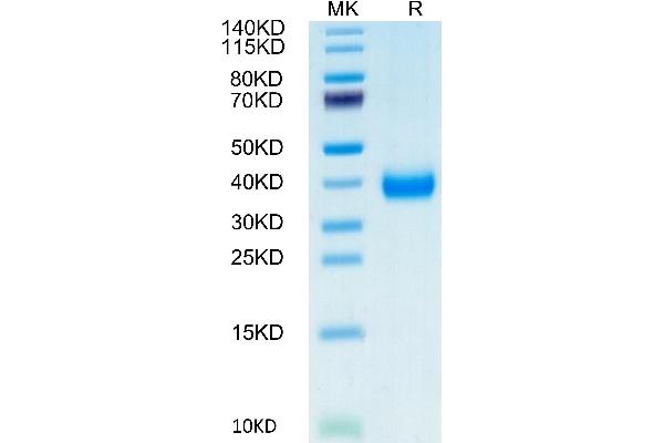 CD161 Protein (AA 67-227) (His-Avi Tag,Biotin)