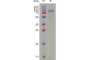 Mouse Protein, hFc Tag on SDS-PAGE under reducing condition. (MMP13 Protein (AA 20-148) (Fc Tag))