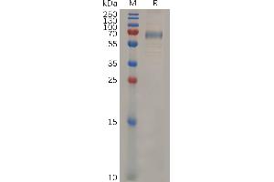 Mouse CD33 Protein, hFc Tag on SDS-PAGE under reducing condition (CD33 Protein (CD33) (AA 18-240) (Fc Tag))