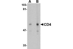 Western Blotting (WB) image for anti-CD4 (CD4) antibody (ABIN1031727) (CD4 anticorps)