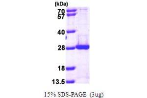 PSMB5 Protein (AA 60-263) (His tag)