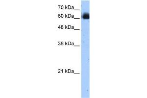 WB Suggested Anti-RELB Antibody Titration:  1. (RELB anticorps  (C-Term))