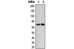 Western blot analysis of Estrogen Receptor alpha (pS118) expression in MCF7 EGF-treated (A), HeLa EGF-treated (B) whole cell lysates. (Estrogen Receptor alpha anticorps  (pSer118))