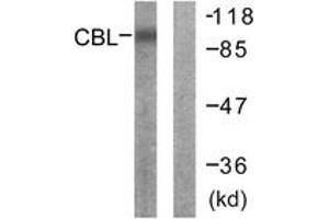 Western blot analysis of extracts from 293 cells, using CBL (Ab-700) Antibody. (CBL anticorps  (AA 666-715))