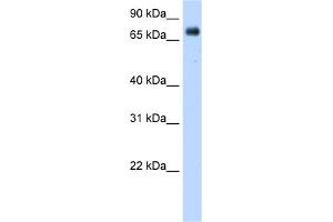 WB Suggested Anti-POR Antibody Titration:  0. (POR anticorps  (Middle Region))