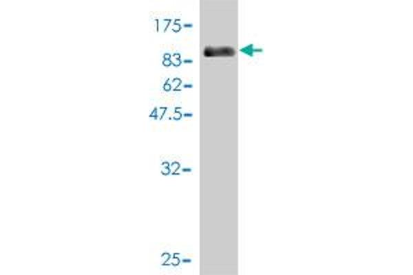 CDK5RAP3 anticorps  (AA 1-506)