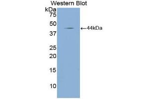 Western blot analysis of the recombinant protein. (NPPA anticorps  (AA 25-152))