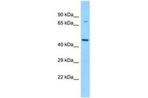 Image no. 1 for anti-Branched Chain Ketoacid Dehydrogenase Kinase (BCKDK) (N-Term) antibody (ABIN6748346) (BCKDK anticorps  (N-Term))