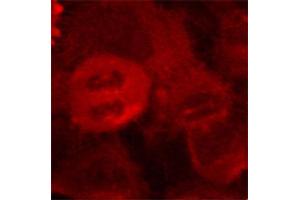 Immunofluorescence staining of methanol-fixed Hela cells using Phospho-MAP2K2-T394 antibody. (MEK2 anticorps  (pThr394))