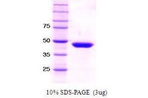 Figure annotation denotes ug of protein loaded and % gel used. (SET7/9 Protéine)