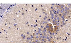 Detection of TNFR1 in Mouse Cerebrum Tissue using Polyclonal Antibody to Tumor Necrosis Factor Receptor 1 (TNFR1) (TNFRSF1A anticorps  (AA 239-433))