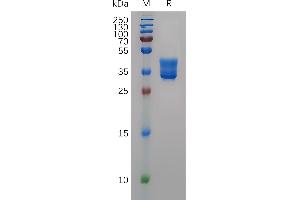 Human Protein, hFc Tag on SDS-PAGE under reducing condition. (HCST Protein (AA 19-48) (Fc Tag))