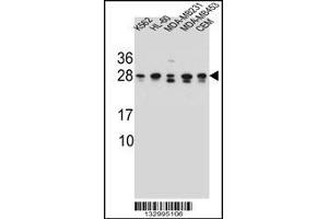 Western blot analysis in K562,HL-60,MDA-MB231,MDA-MB453,CEM cell line lysates (35ug/lane). (RAB3D anticorps  (C-Term))