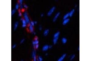 Immunofluorescence analysis of Mouse heart tissue using α-SMA Polyclonal Antibody at dilution of 1:200. (alpha-SMA anticorps)