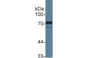 Detection of ENG in Human Lung lysate using Monoclonal Antibody to Endoglin (ENG) (Endoglin anticorps  (AA 26-136))