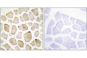 Immunohistochemistry analysis of paraffin-embedded human skeletal muscle tissue, using MAPK3 Antibody. (ERK1 anticorps  (AA 301-350))