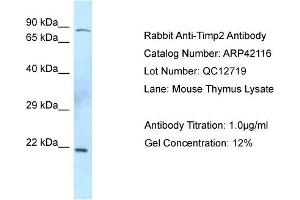WB Suggested Anti-Timp2 Antibody  Titration: 0. (TIMP2 anticorps  (C-Term))