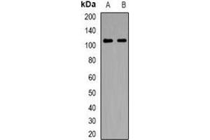 Western blot analysis of NLRX1 expression in HepG2 (A), Hela (B) whole cell lysates. (NLRX1 anticorps)