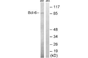 Western blot analysis of extracts from 293 cells, using Bcl-6 (Ab-333) antibody. (BCL6 anticorps  (Ser333))