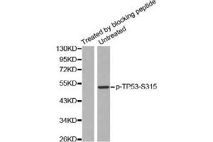 Western blot analysis of extracts from Hela cells, using Phospho-TP53-S315 antibody. (p53 anticorps  (pSer315))