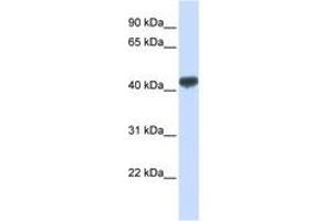 Image no. 1 for anti-Zinc Finger Protein 265 (Zranb2) (AA 72-121) antibody (ABIN6740510) (ZNF265 anticorps  (AA 72-121))