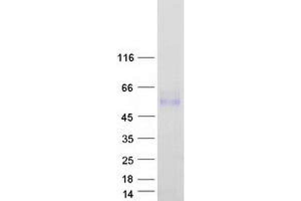 LRTM2 Protein (Transcript Variant 2) (Myc-DYKDDDDK Tag)