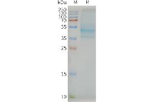 Human -Nanodisc, Flag Tag on SDS-PAGE (CCR7 Protéine)