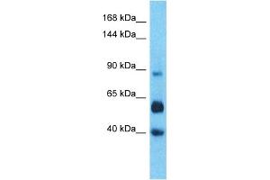 Host:  Rabbit  Target Name:  LRC66  Sample Type:  Liver Tumor lysates  Antibody Dilution:  1. (LRRC66 anticorps  (C-Term))