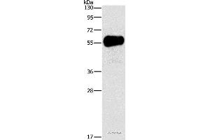 Western blot analysis of Mouse pancreas tissue, using AMY2A Polyclonal Antibody at dilution of 1:1550 (AMY2A anticorps)