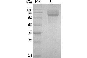 Greater than 95 % as determined by reducing SDS-PAGE. (IL22RA2 Protein (Fc Tag))