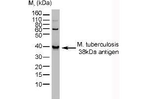 Western Blotting (WB) image for anti-Mycobacterium Tuberculosis antibody (ABIN2475767) (M. tuberculosis anticorps)