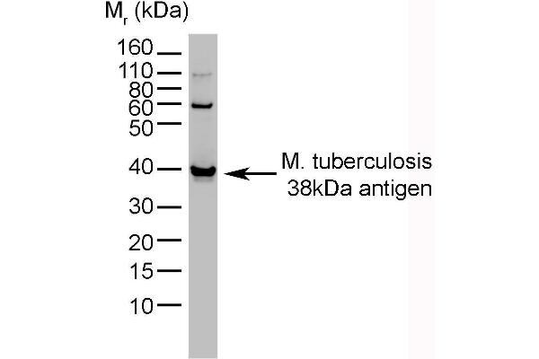 M. tuberculosis anticorps