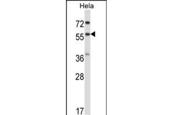 RANGAP1 anticorps  (N-Term)