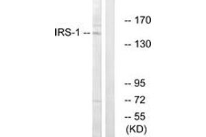 Western blot analysis of extracts from NIH-3T3 cells, using IRS-1 (Ab-312) Antibody. (IRS1 anticorps  (AA 279-328))