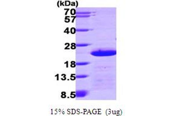 CETN2 Protein (AA 1-172) (His tag)