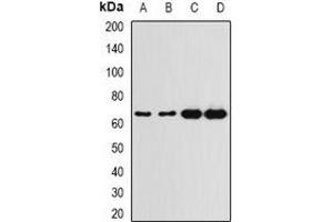 Western blot analysis of G6PD expression in A549 (A), HT29 (B), K562 (C), mouse spleen (D) whole cell lysates. (Glucose-6-Phosphate Dehydrogenase anticorps)