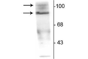 Western blot of T47D cell lysate prepared from cells that had been incubated in the presence of the synthetic progestin agonist R5020 (500 nM) showing specific immunolabeling of the ~90 kDa PR-A isoform and the ~120 kDa PR-B isoform of the progesterone receptor phosphorylated at Ser190. (Progesterone Receptor anticorps  (pSer190))