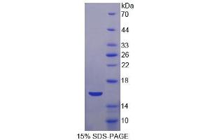 SDS-PAGE (SDS) image for Apolipoprotein A-IV (APOA4) ELISA Kit (ABIN6574299)