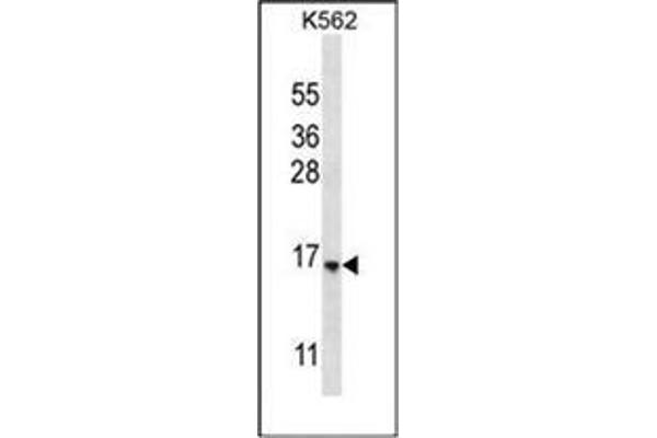 STARD5 anticorps  (N-Term)