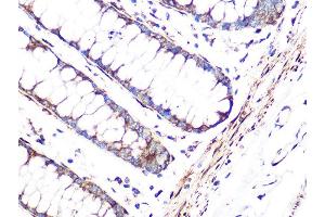 Immunohistochemistry of paraffin-embedded human colon using FHL1 Rabbit mAb (ABIN1680536, ABIN3019332, ABIN3019333 and ABIN7101753) at dilution of 1:100 (40x lens). (FHL1 anticorps)