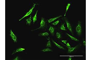 Immunofluorescence of purified MaxPab antibody to DAXX on HeLa cell. (DAXX anticorps  (AA 1-740))
