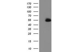 HEK293T cells were transfected with the pCMV6-ENTRY control (Left lane) or pCMV6-ENTRY SNTA1 (Right lane) cDNA for 48 hrs and lysed. (SNTA1 anticorps)